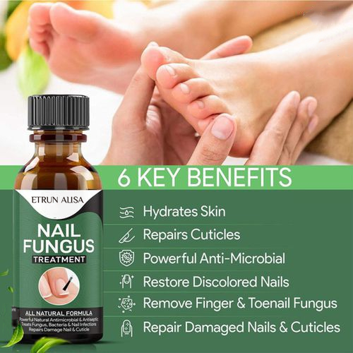 Nail Fungus Solution
